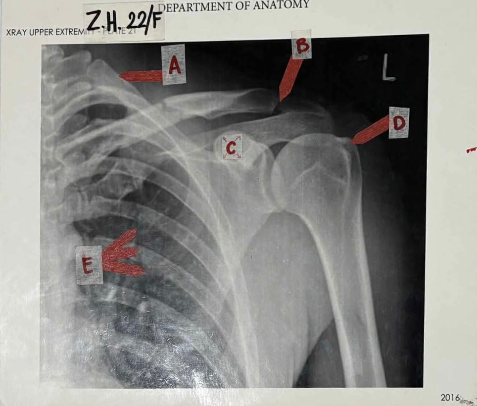 Case 4: Zoey's Battle Slam Injury