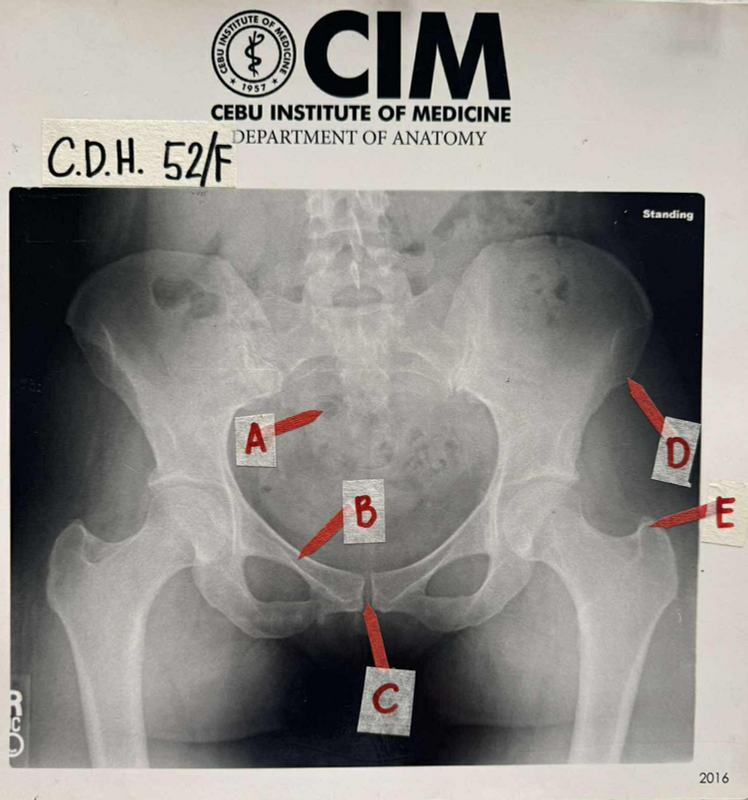 Case 7: Celine's Post-Concert Hip Pain